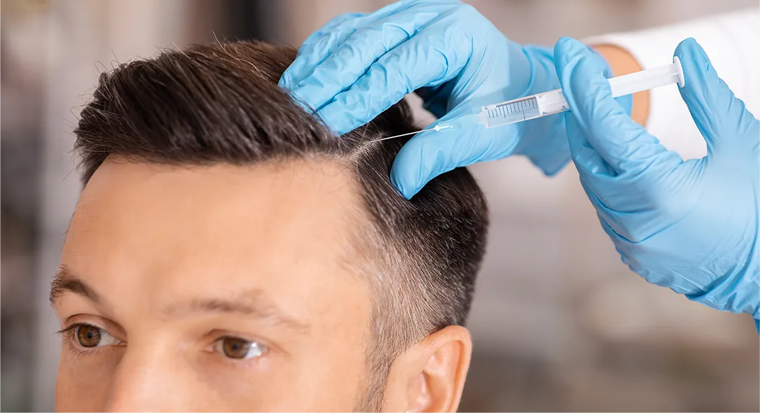 Man receiving PRF scalp injection treatment